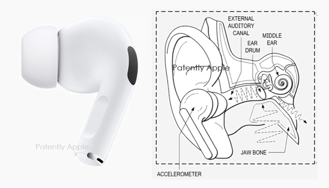 苹果新专利 | AirPods或将提供磨牙症的诊断和监测-我爱音频网